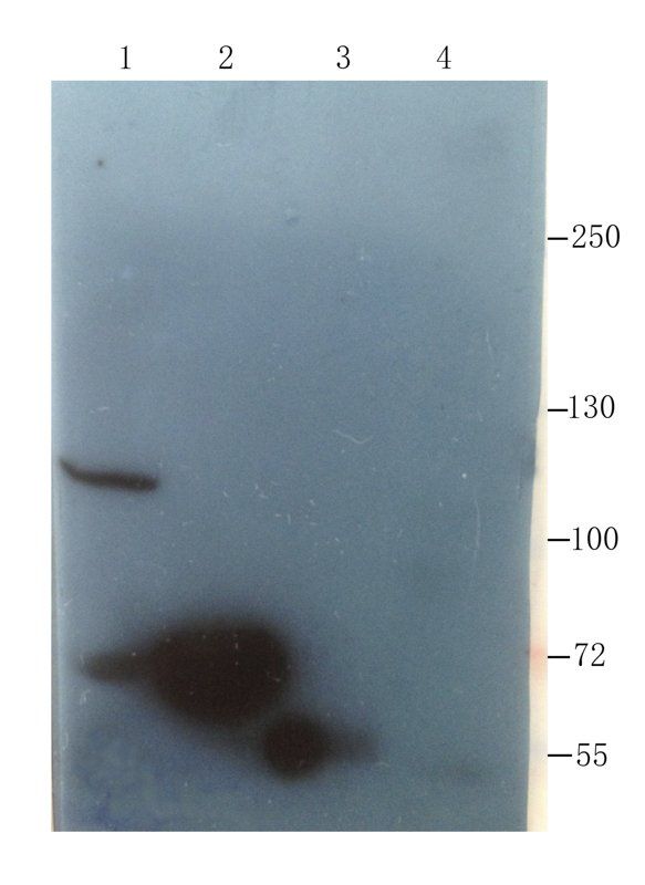 Factor VIII antibody