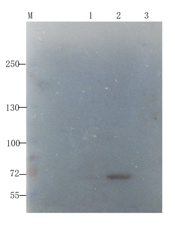 Factor VIII antibody