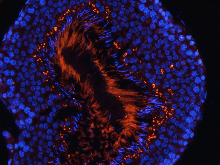 Factor VIII antibody