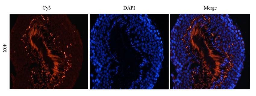 Factor VIII antibody