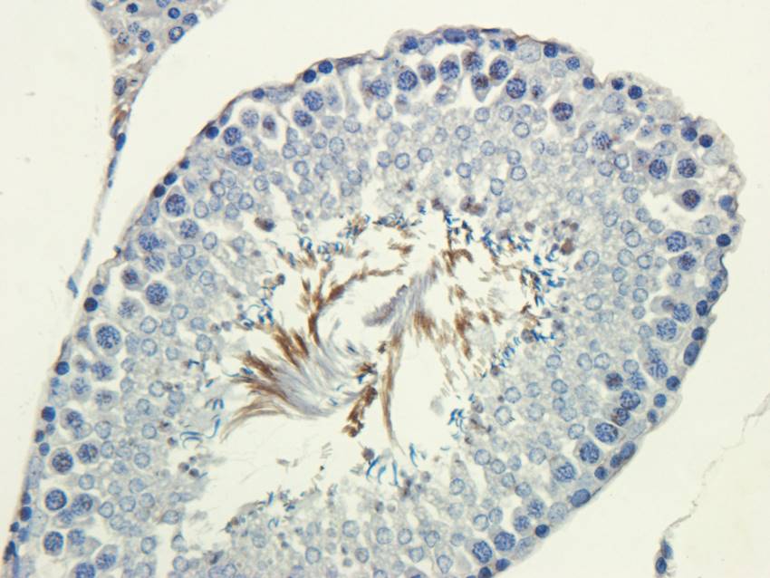 Factor VIII antibody