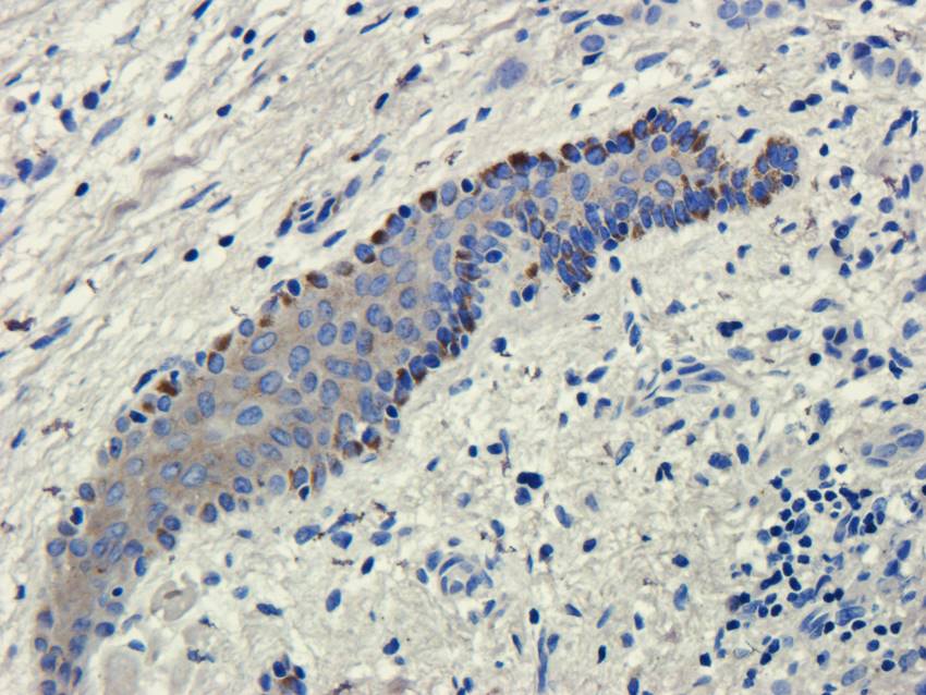 Factor VIII antibody