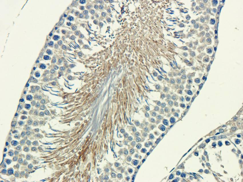 Factor VIII antibody