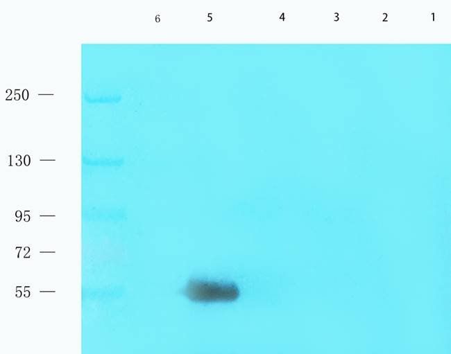 Factor VIII antibody