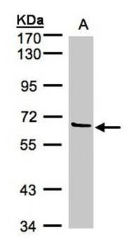 Factor XI antibody