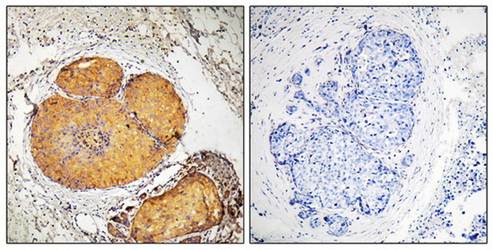 FADD (Phospho-Ser191) Antibody