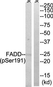 FADD (Phospho-Ser191) Antibody