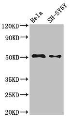 FADS1 Antibody