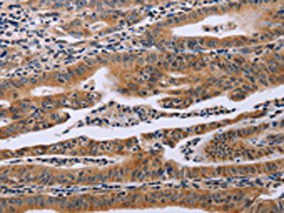 FAF1 Antibody