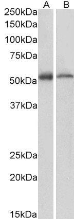 Goat anti-ETEA / UBXD8 Antibody