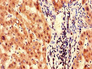 FAH Antibody