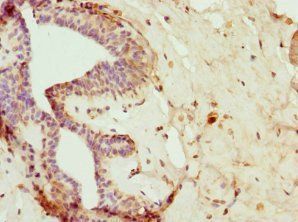 FAIM2 Antibody