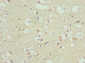 FAIM2 Antibody