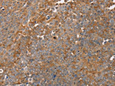 FAIM2 Antibody