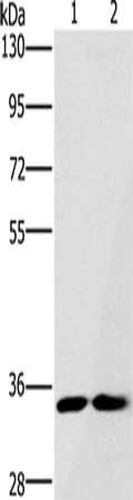 FAIM2 Antibody