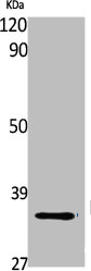FAIM2 Antibody