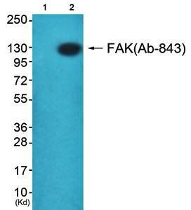 FAK antibody