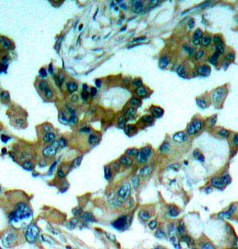 FAK (Ab-861) Antibody