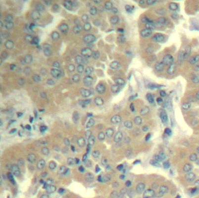 FAK (Ab-576/577) Antibody