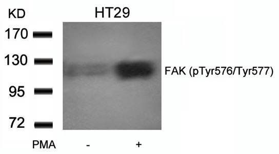 FAK (phospho-Tyr576/Tyr577) Antibody
