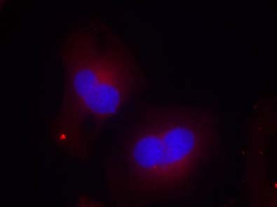 FAK (Phospho-Tyr925) Antibody