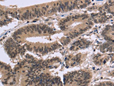 FAM107A Antibody