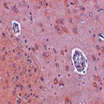 FAM120A Rabbit Polyclonal Antibody