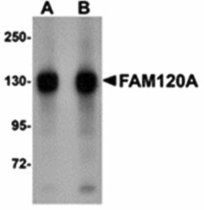 FAM120A Rabbit Polyclonal Antibody