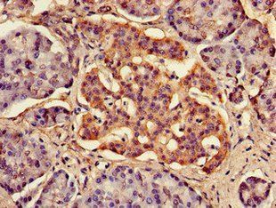 FAM134B Antibody