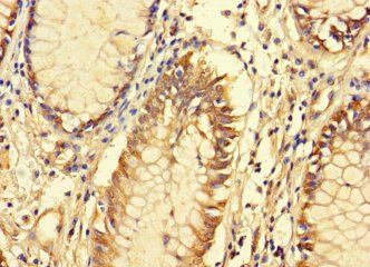FAM135B Antibody