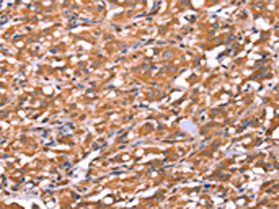 FAM13B Antibody