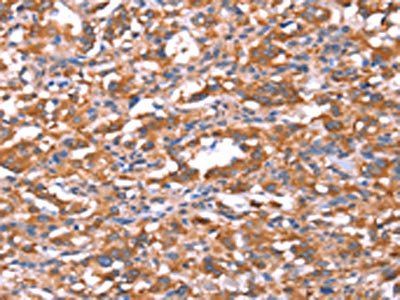 FAM13B Antibody