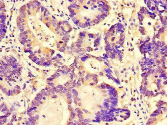 FAM151B Antibody