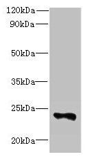 FAM156A Antibody