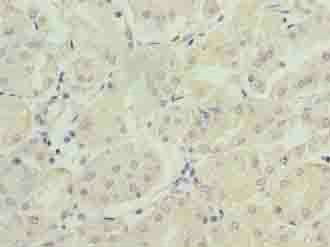 FAM168B Antibody
