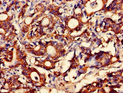 FAM168B Antibody