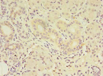 FAM174A Antibody