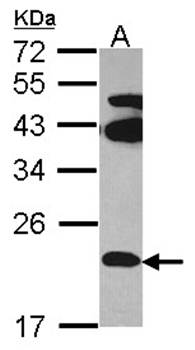 FAM18B Rabbit Polyclonal Antibody