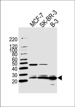 FAM216B antibody