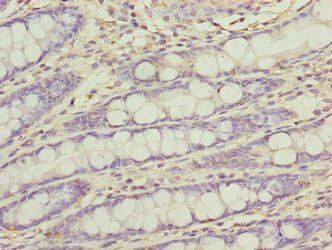 FAM222B Antibody