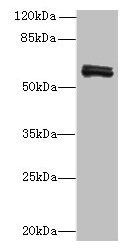 FAM222B Antibody