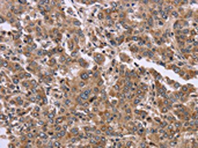 FAM3B Antibody