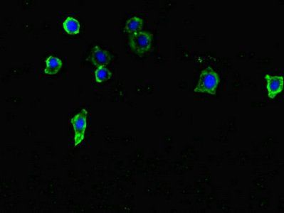 TENT5C Antibody