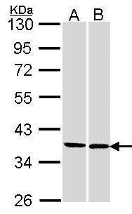 PEF1 antibody [N2C3]