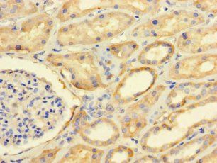FAM71A Antibody