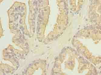 FAM78A Antibody