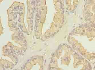 FAM78A antibody