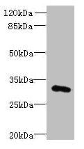 FAM78A Antibody