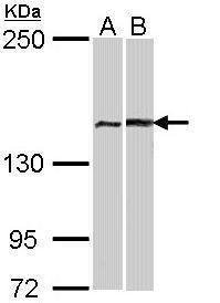 FANCA antibody [N1], N-term