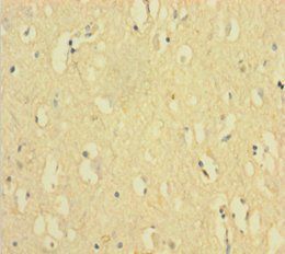 FANCD2 Antibody